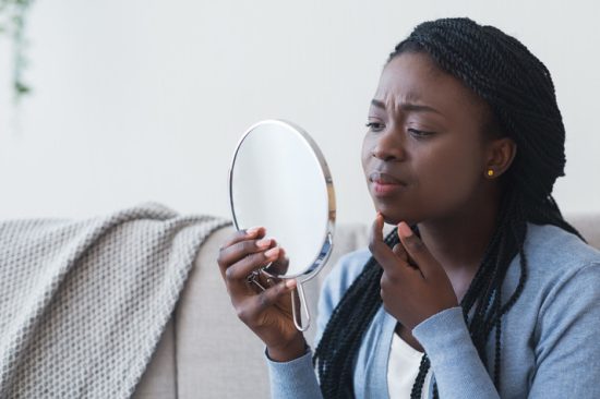 African-American-acne