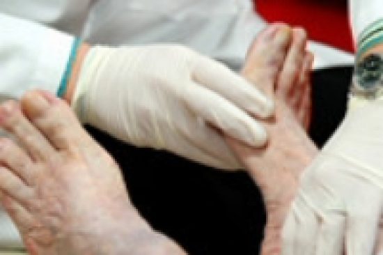 Diabetes-foot-exam