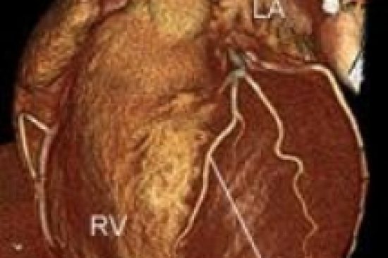 cardiac-ct_NLM2